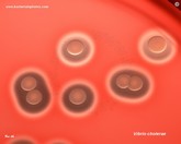 vibrio cholerae colonies appearance on blood agar